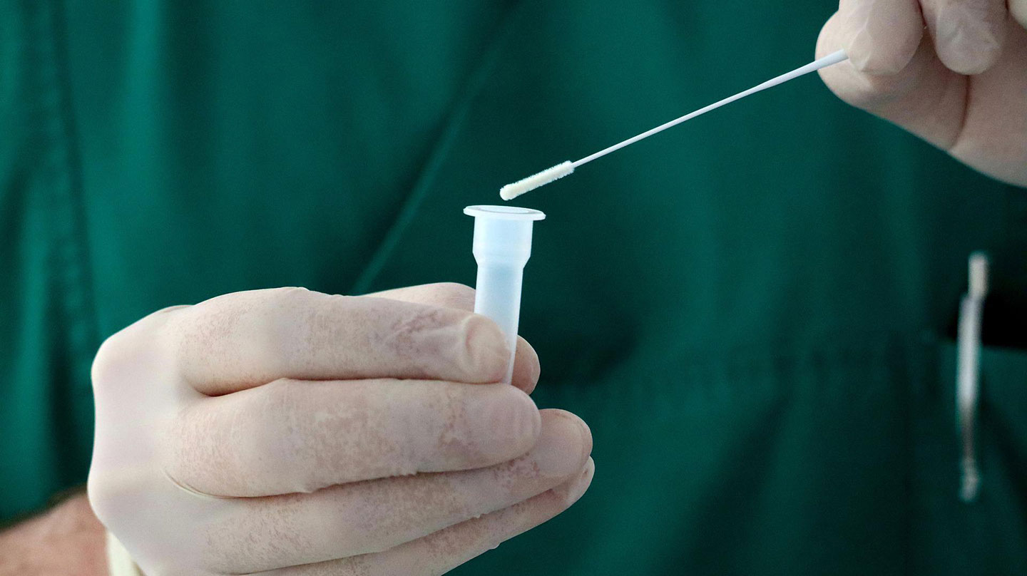 Corona-Antigentest Coronatest